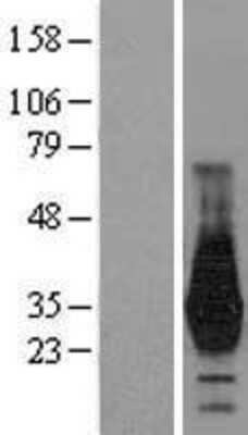 Western Blot: HOXD4 Overexpression Lysate [NBL1-11683]