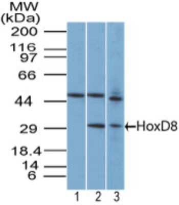 Western Blot: HOXD8 Antibody [NBP2-27108]