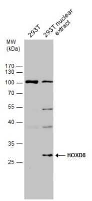 Western Blot: HOXD8 Antibody [NBP3-12892]