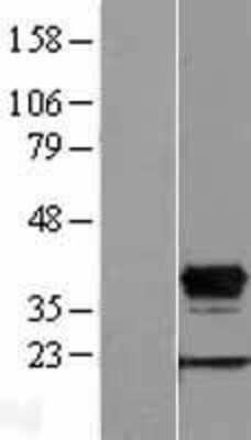 Western Blot: HOXD8 Overexpression Lysate [NBL1-11684]