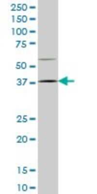 Western Blot: HOXD9 Antibody (2A9) [H00003235-M01]