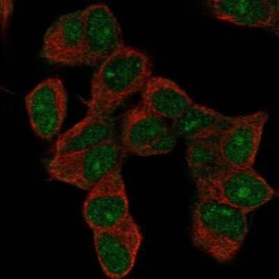 Immunocytochemistry/ Immunofluorescence: HOXD9 Antibody [NBP2-55738]