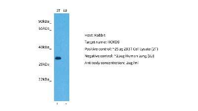 Western Blot: HOXD9 Antibody [NBP2-85076]