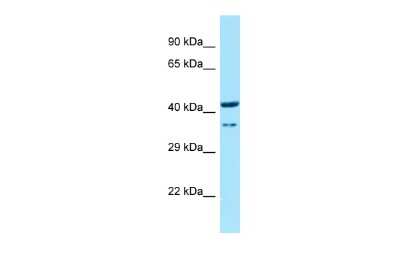 Western Blot: HOXD9 Antibody [NBP2-85077]