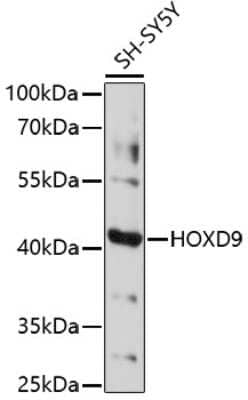 Western Blot: HOXD9 AntibodyAzide and BSA Free [NBP3-03891]