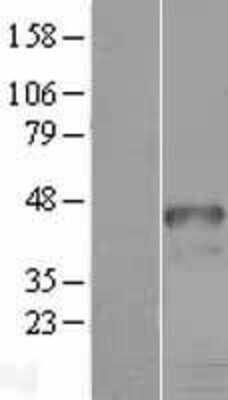 Western Blot: HOXD9 Overexpression Lysate [NBL1-11685]