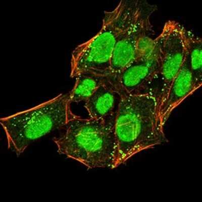 Immunocytochemistry/ Immunofluorescence: HP1 alpha Antibody (3A11F8) - BSA Free [NBP2-52434]