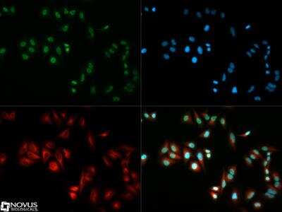 Immunocytochemistry/ Immunofluorescence: HP1 alpha Antibody [NB100-2518]