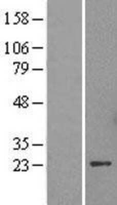 Western Blot: HP1 alpha Overexpression Lysate [NBL1-08750]