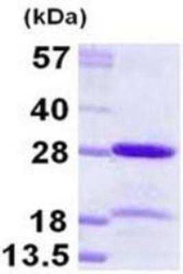 SDS-PAGE: Recombinant Human HP1 alpha His Protein [NBP1-98863]