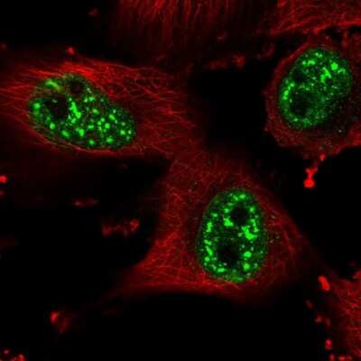 Immunocytochemistry/ Immunofluorescence: HP1BP3 Antibody [NBP2-55069]