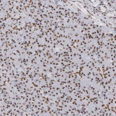 Immunohistochemistry-Paraffin: HP1BP3 Antibody [NBP1-83229]