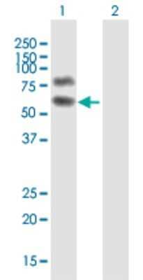 Western Blot: HP1BP3 Antibody [H00050809-B01P]