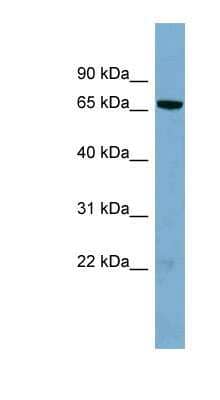 Western Blot: HP1BP3 Antibody [NBP1-55329]