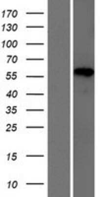 Western Blot: HP1BP3 Overexpression Lysate [NBP2-07058]