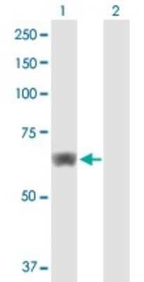 Western Blot: HPCL Antibody [H00026061-B01P]