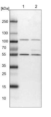 Western Blot: HPCL Antibody [NBP1-89384]