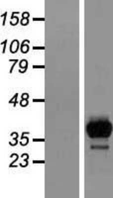 Western Blot: HPCL Overexpression Lysate [NBL1-11434]