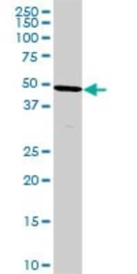 Western Blot: HPD Antibody (2F3) [H00003242-M07]