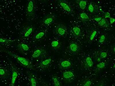 Immunocytochemistry/ Immunofluorescence: HPD Antibody [NBP2-98599]