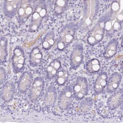 Immunohistochemistry-Paraffin: HPD Antibody [NBP2-32657]