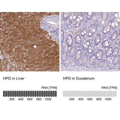 Immunohistochemistry-Paraffin: HPD Antibody [NBP2-32657]