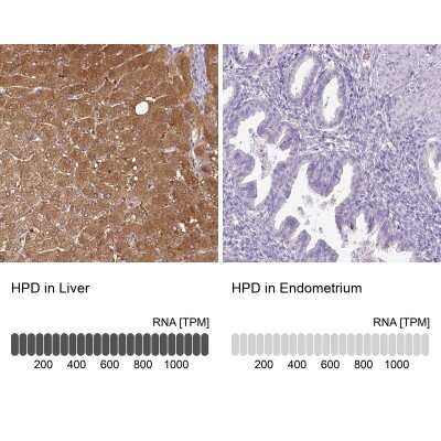Immunohistochemistry-Paraffin: HPD Antibody [NBP2-32657]