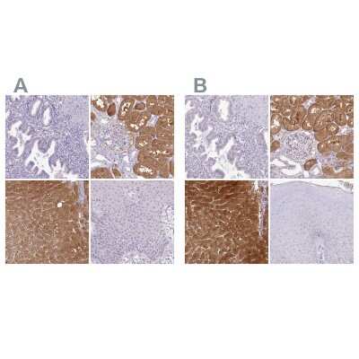 Immunohistochemistry-Paraffin: HPD Antibody [NBP2-32657]