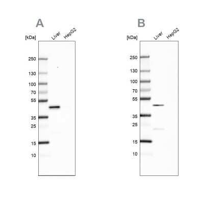 Western Blot: HPD Antibody [NBP2-32657]