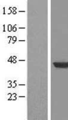 Western Blot: HPD Overexpression Lysate [NBL1-11691]