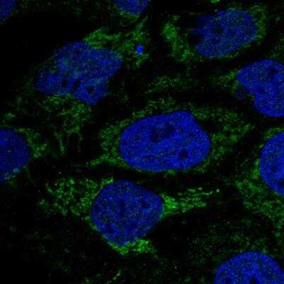 Immunocytochemistry/ Immunofluorescence: HPDL Antibody [NBP1-89365]