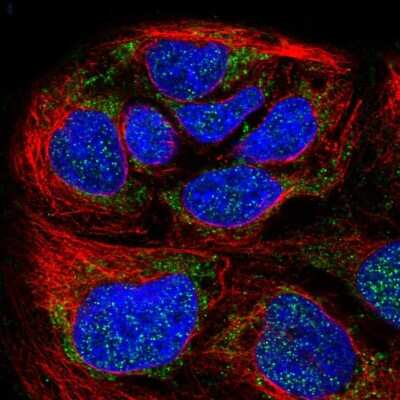 Immunocytochemistry/ Immunofluorescence: HPDL Antibody [NBP2-56714]