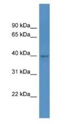 Western Blot: HPDL Antibody [NBP1-79857]