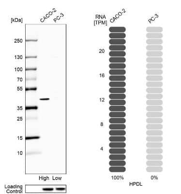 Western Blot: HPDL Antibody [NBP1-89365]