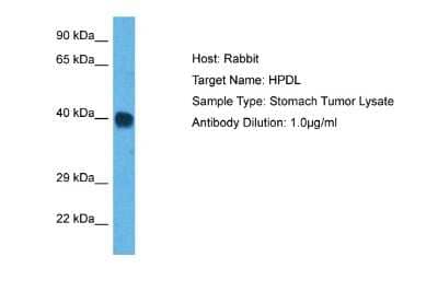 Western Blot: HPDL Antibody [NBP2-87600]