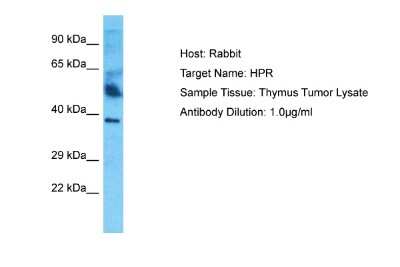 Western Blot: HPR Antibody [NBP2-84078]