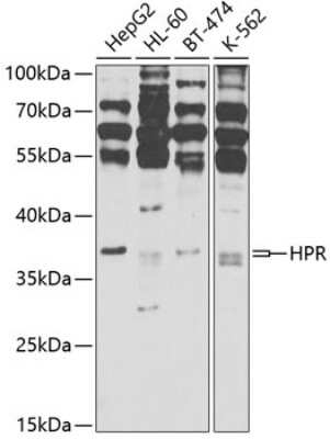 Western Blot: HPR AntibodyBSA Free [NBP3-04841]