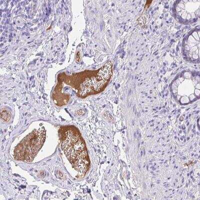 Immunohistochemistry-Paraffin: HPRG Antibody [NBP2-33723]