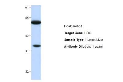 Western Blot: HPRG Antibody [NBP1-80492]