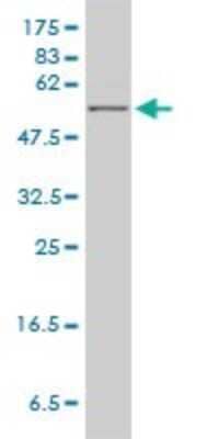 Western Blot: HPRT Antibody (4C3-G8) [H00003251-M01]