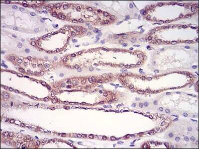 Immunohistochemistry-Paraffin: HPRT Antibody (5F11A7) - BSA Free [NBP2-37245]