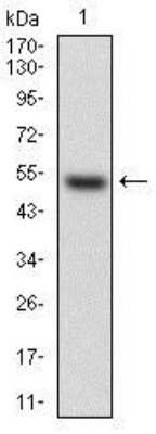 Western Blot: HPRT Antibody (5F11A7)BSA Free [NBP2-37245]