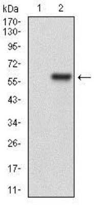 Western Blot: HPRT Antibody (5F11A7)BSA Free [NBP2-37245]