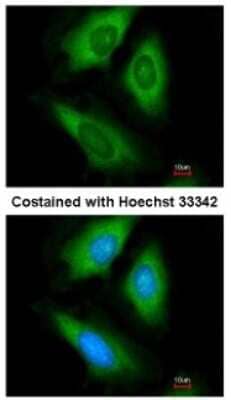 Immunocytochemistry/ Immunofluorescence: HPRT Antibody [NBP1-33527]