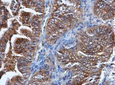 Immunohistochemistry-Paraffin: HPRT Antibody [NBP1-33527]