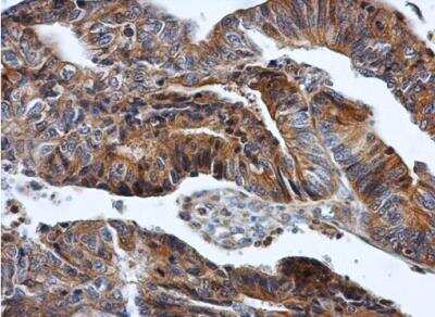Immunohistochemistry-Paraffin: HPRT Antibody [NBP1-33527]