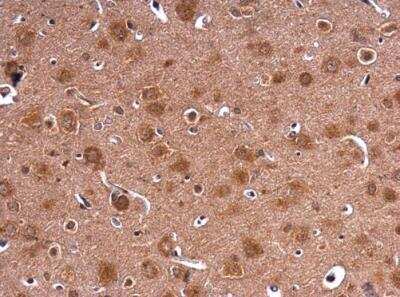 Immunohistochemistry-Paraffin: HPRT Antibody [NBP1-33527]