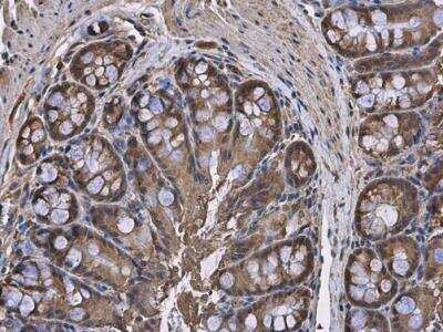 Immunohistochemistry-Paraffin: HPRT Antibody [NBP1-33527]