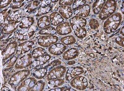 Immunohistochemistry-Paraffin: HPRT Antibody [NBP1-33527]