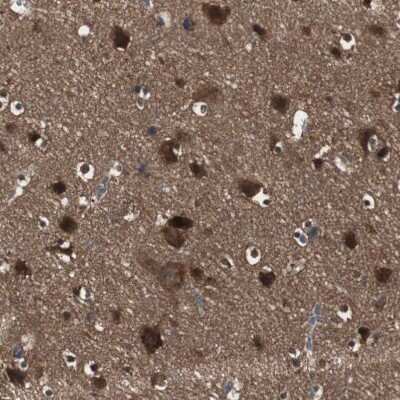 Immunohistochemistry-Paraffin: HPRT Antibody [NBP1-92006]